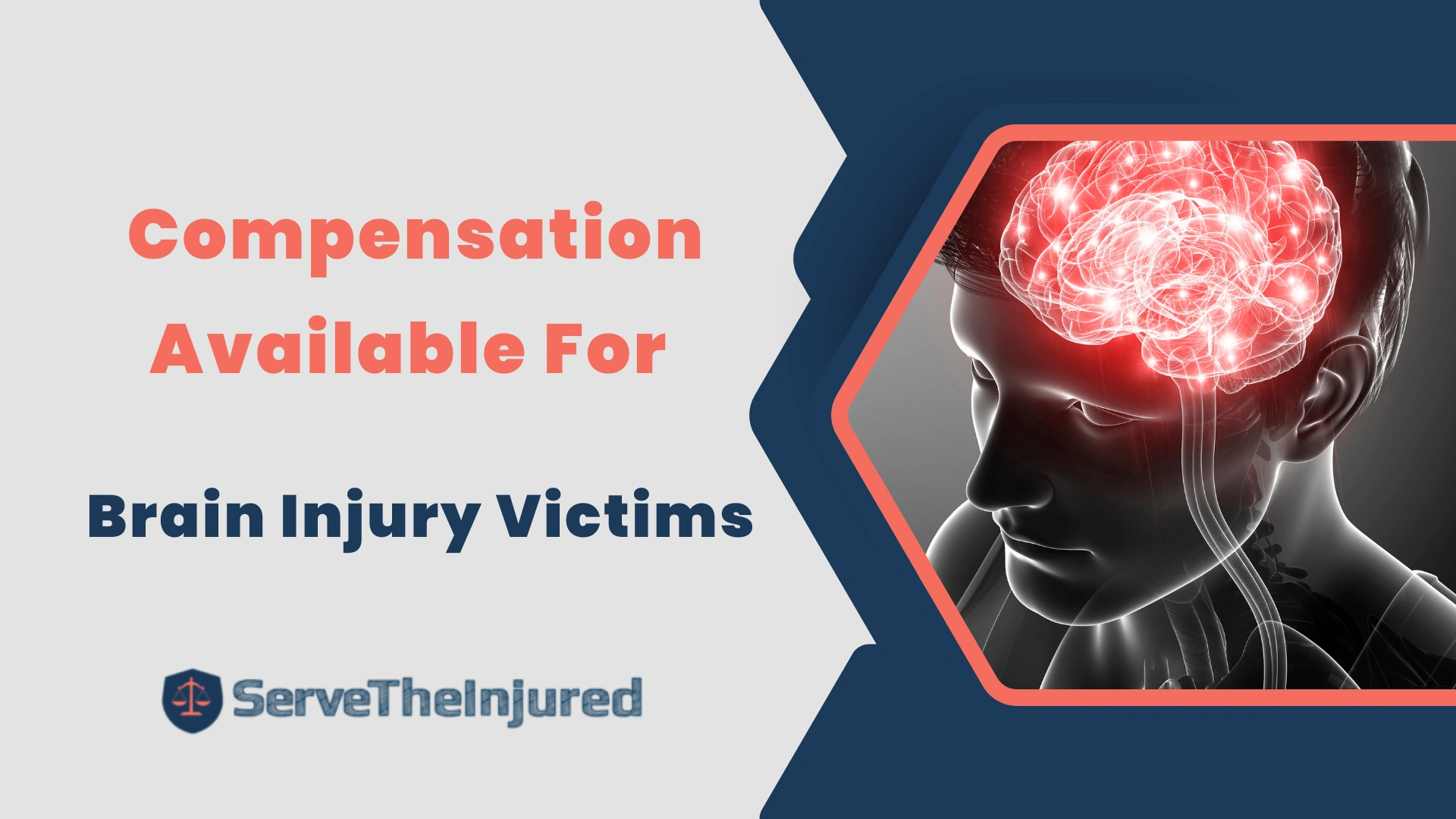 Compensation Available For Brain Injury Victims